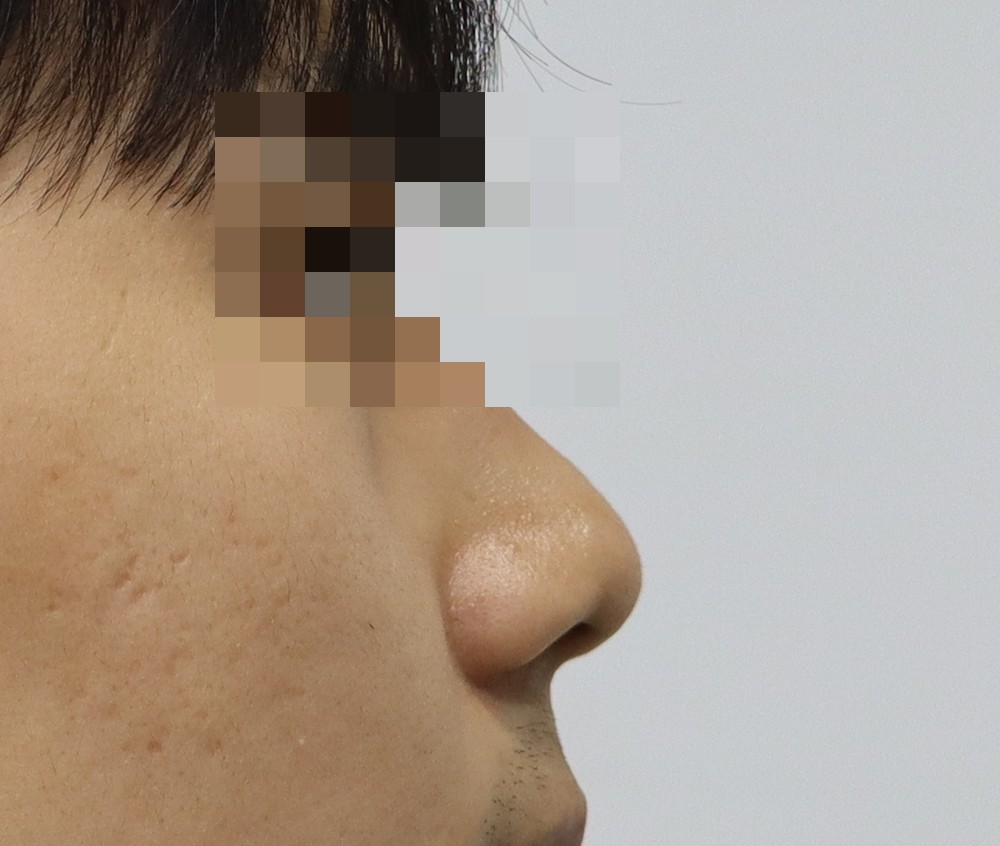 手術前